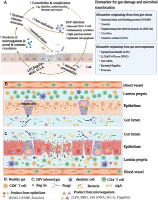 Relevance of biomarkers indicating gut damage and microbial translocation in people living with HIV